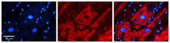 UGT2B4 Rabbit Polyclonal Antibody