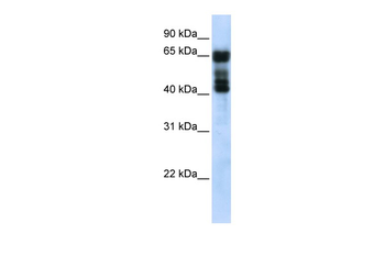 UGT2B4 Rabbit Polyclonal Antibody