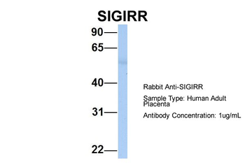 SIGIRR Rabbit Polyclonal Antibody