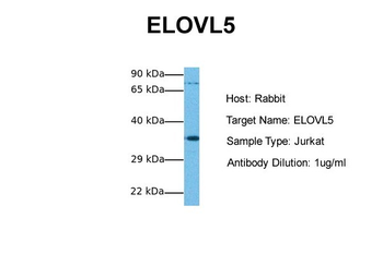 ELOVL5 Rabbit Polyclonal Antibody