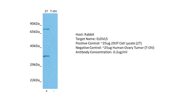 ELOVL5 Rabbit Polyclonal Antibody