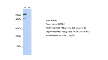 FAM38B Rabbit Polyclonal Antibody
