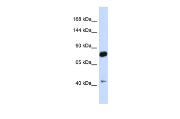 CDH23 Rabbit Polyclonal Antibody