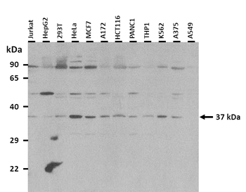 TNMD Rabbit Polyclonal Antibody
