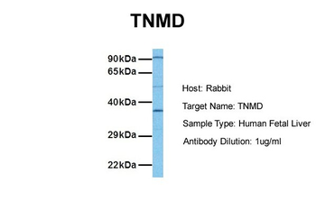 TNMD Rabbit Polyclonal Antibody