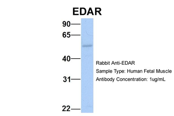 EDAR Rabbit Polyclonal Antibody