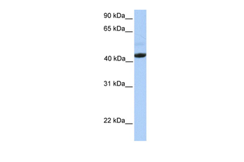EDAR Rabbit Polyclonal Antibody