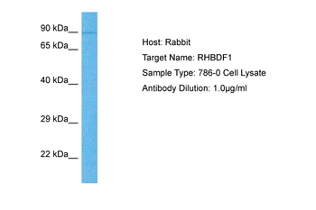 RHBDF1 Rabbit Polyclonal Antibody