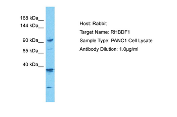 RHBDF1 Rabbit Polyclonal Antibody