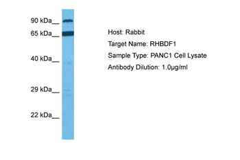 RHBDF1 Rabbit Polyclonal Antibody
