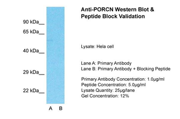 PORCN Rabbit Polyclonal Antibody