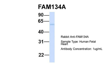 RETREG2 Rabbit Polyclonal Antibody