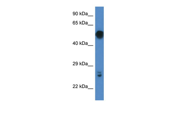 Gal3st4 Rabbit Polyclonal Antibody