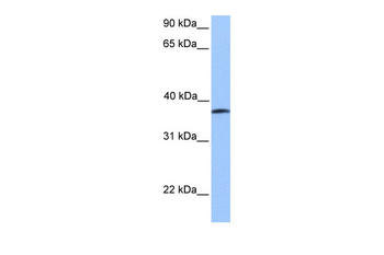 UBA5 Rabbit Polyclonal Antibody