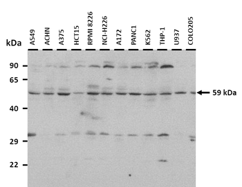 LPCAT1 Rabbit Polyclonal Antibody