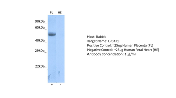 LPCAT1 Rabbit Polyclonal Antibody