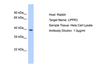 PLPPR3 Rabbit Polyclonal Antibody