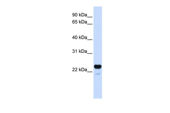 C1QTNF1 Rabbit Polyclonal Antibody