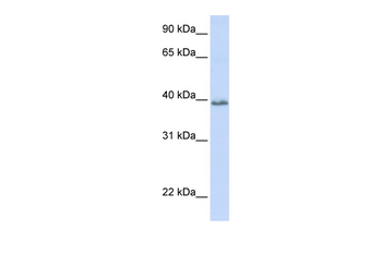 TSPAN10 Rabbit Polyclonal Antibody
