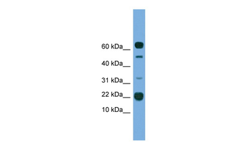 TMEM107 Rabbit Polyclonal Antibody
