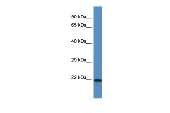Tmem147 Rabbit Polyclonal Antibody