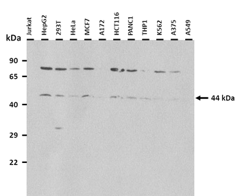 BSCL2 Rabbit Polyclonal Antibody