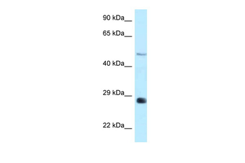 GPAT3 Rabbit Polyclonal Antibody
