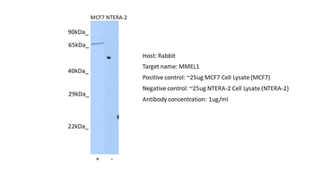 MMEL1 Rabbit Polyclonal Antibody