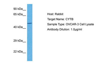 CYTB Rabbit Polyclonal Antibody