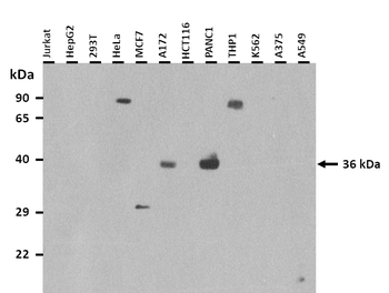 ASB5 Rabbit Polyclonal Antibody