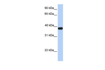 ASB5 Rabbit Polyclonal Antibody