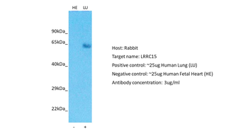 LRRC15 Rabbit Polyclonal Antibody