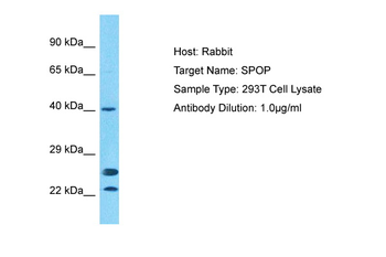 SPOP Rabbit Polyclonal Antibody