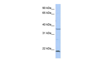 SPRY2 Rabbit Polyclonal Antibody
