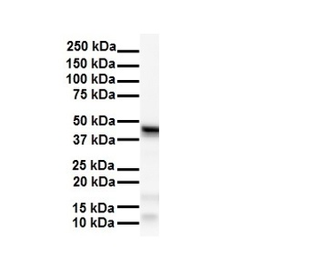 SMYD5 Rabbit Polyclonal Antibody