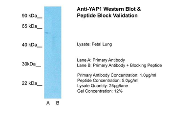 YAP1 Rabbit Polyclonal Antibody
