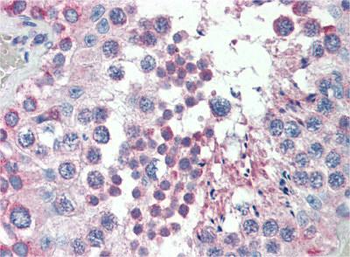 MED4 Rabbit Polyclonal Antibody