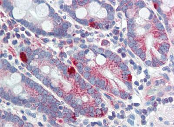 MED4 Rabbit Polyclonal Antibody