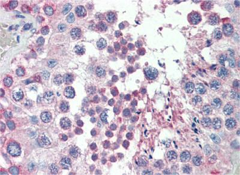 MED4 Rabbit Polyclonal Antibody