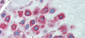 LIMD1 Rabbit Polyclonal Antibody