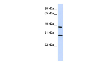 ING4 Rabbit Polyclonal Antibody