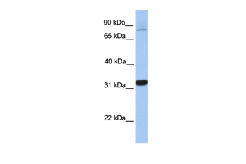 TIPIN Rabbit Polyclonal Antibody