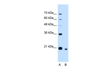 CDCA4 Rabbit Polyclonal Antibody
