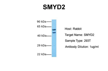 SMYD2 Rabbit Polyclonal Antibody