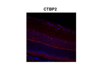 CTBP2 Rabbit Polyclonal Antibody