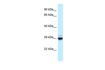 Maf1 Rabbit Polyclonal Antibody