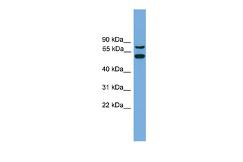 YY1AP1 Rabbit Polyclonal Antibody