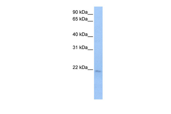 SPATA12 Rabbit Polyclonal Antibody