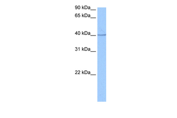 SP6 Rabbit Polyclonal Antibody
