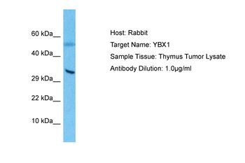 YBX1 Rabbit Polyclonal Antibody